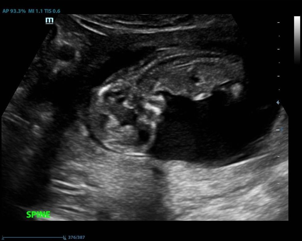 280a7fdc e846 41cc a21c 06f3f04284fb