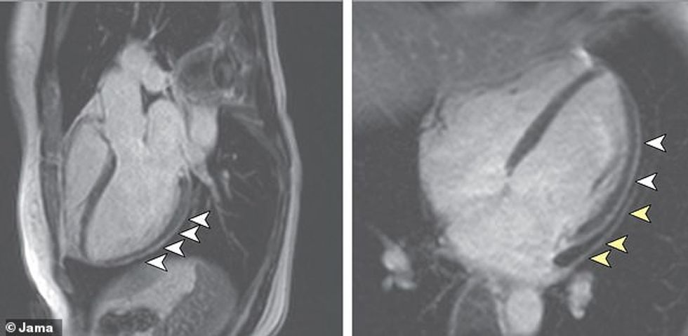 31255814 8565201 image m 2 1595875952035