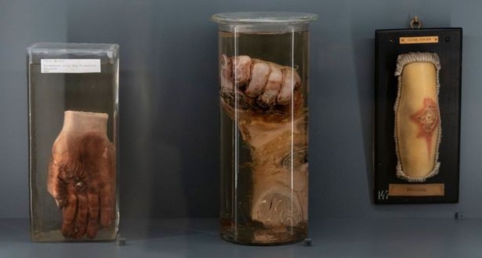 4 AUSTRIA MUSEUM ANATOMY ETHICS