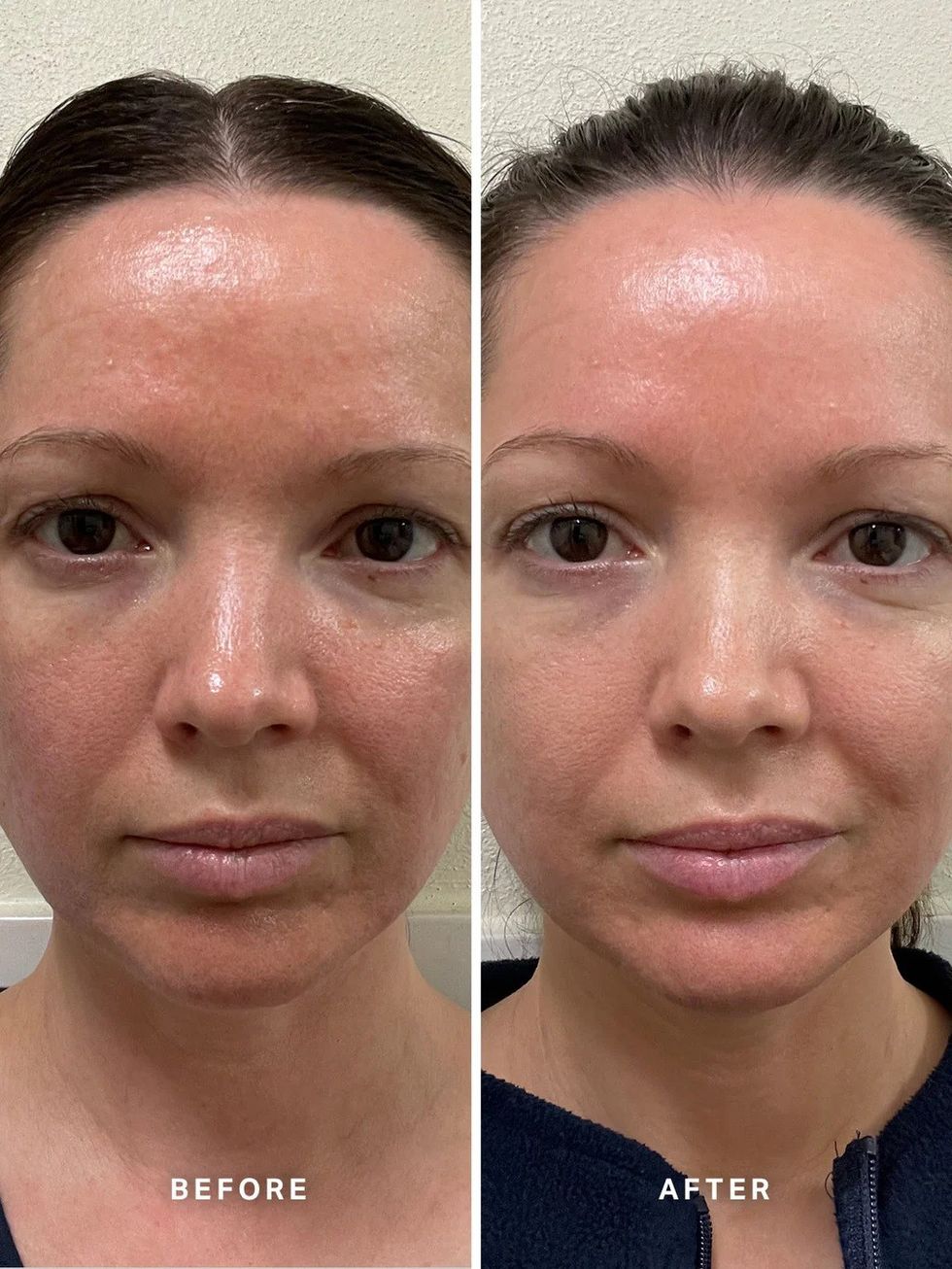 4 Week Trial Vitamin B Serum Kelly Powell