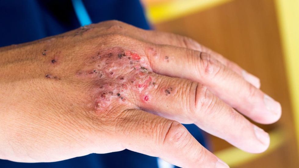 4159231 shutterstock 434961346 ff