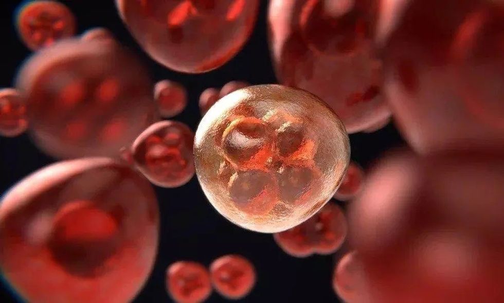 418417 ezgifcom gif maker 2022 06 07t151737372