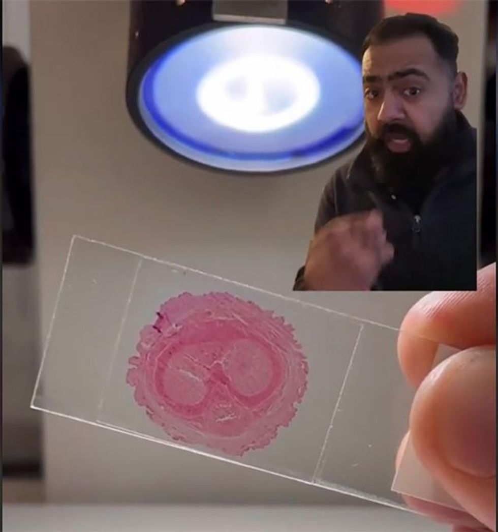 4b44494b87ac525713bdba9d126f49b3