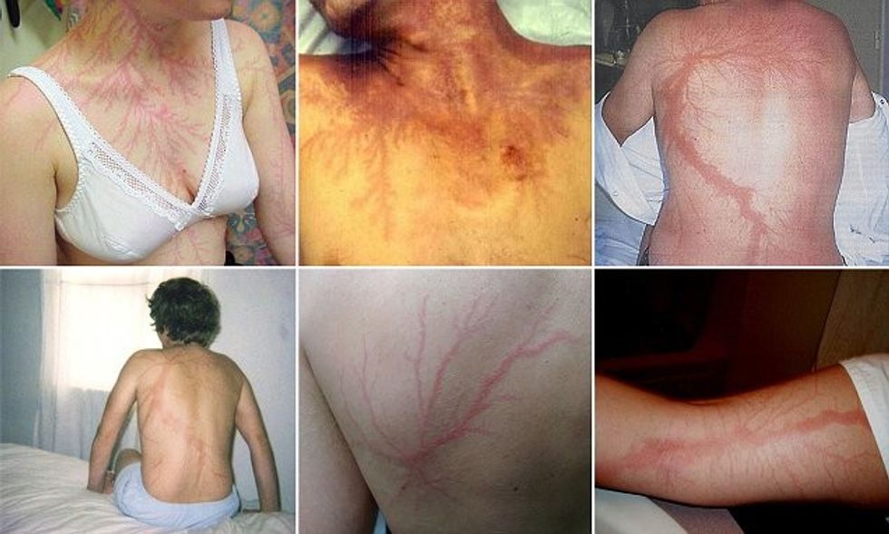 4F100BBF00000578 0 image a 98 1534154646539