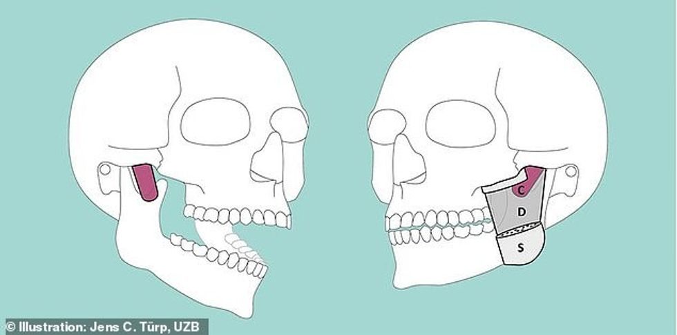 52191155 10343005 image m 25 1640364843834