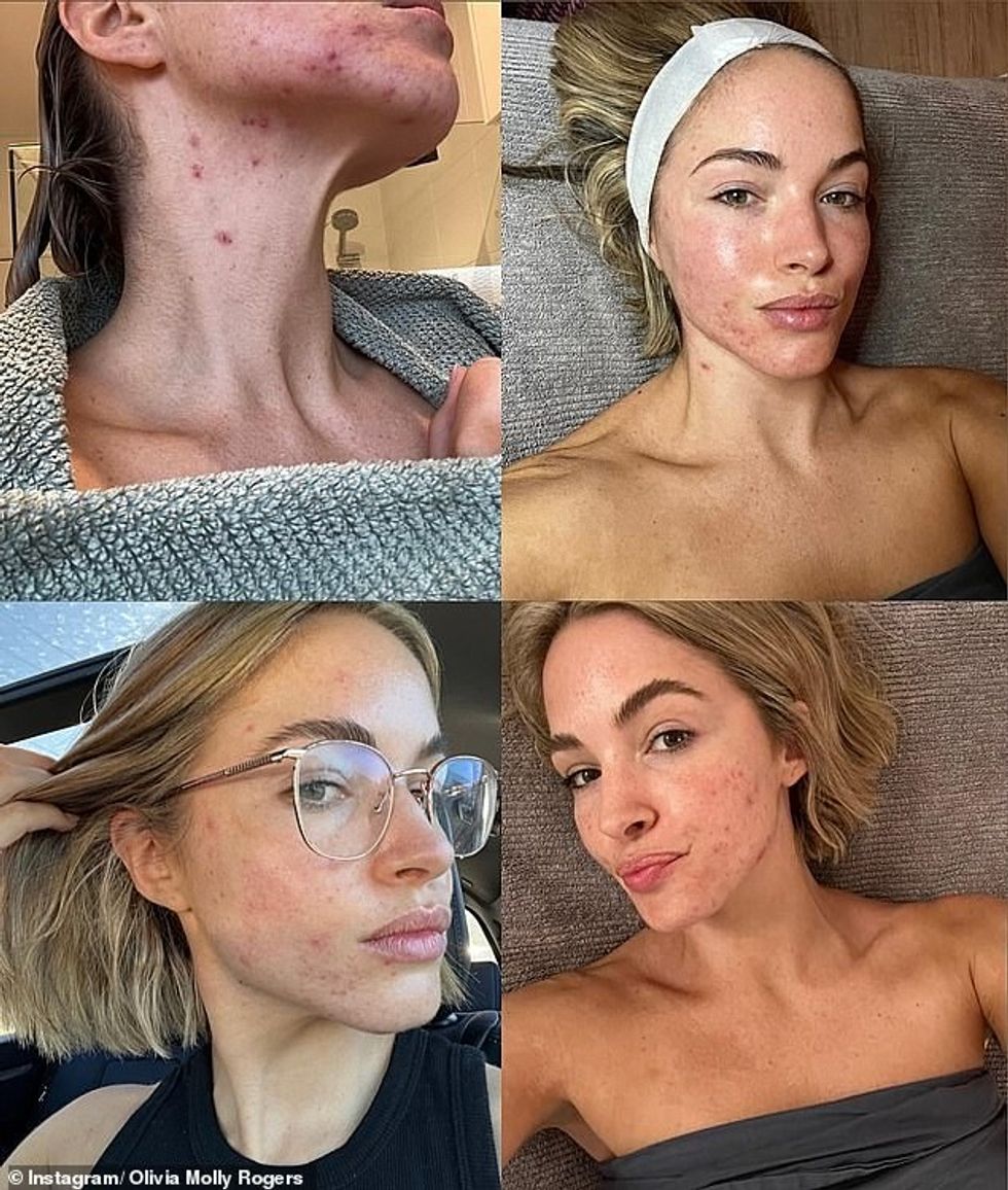 55404091 10617175 image a 2 1647389981716