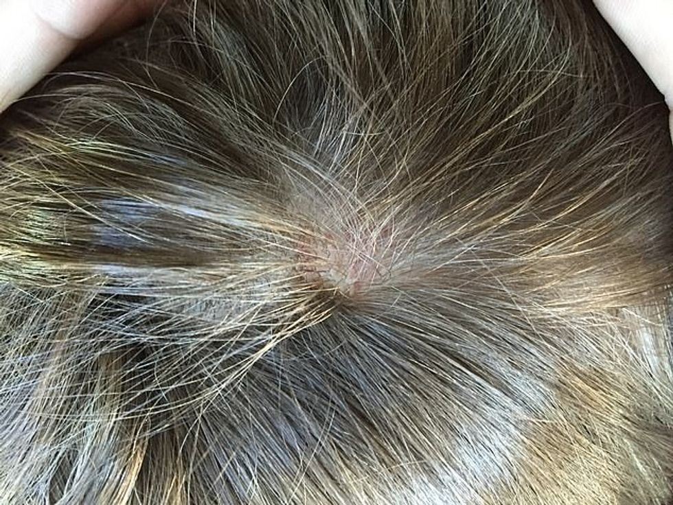 57468167 10789317 She said He had his hand on the back of my hair and was yanking a 1 1651840632655