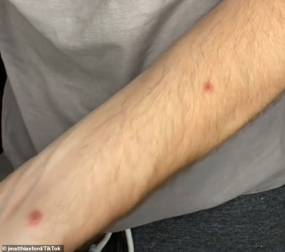 59638759 10962529 Ford said he took painkillers because one of the spots around hi a 2 1656602981012