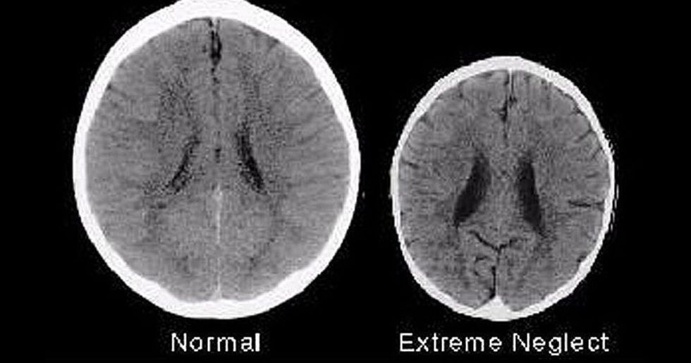 5d029e54250000a013e63a91