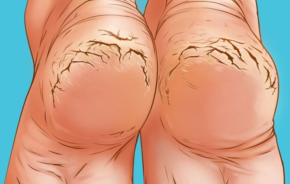 5ebe315e3b90ba864325e43b85