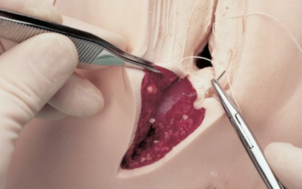 60225 deep musculature suturing(1)