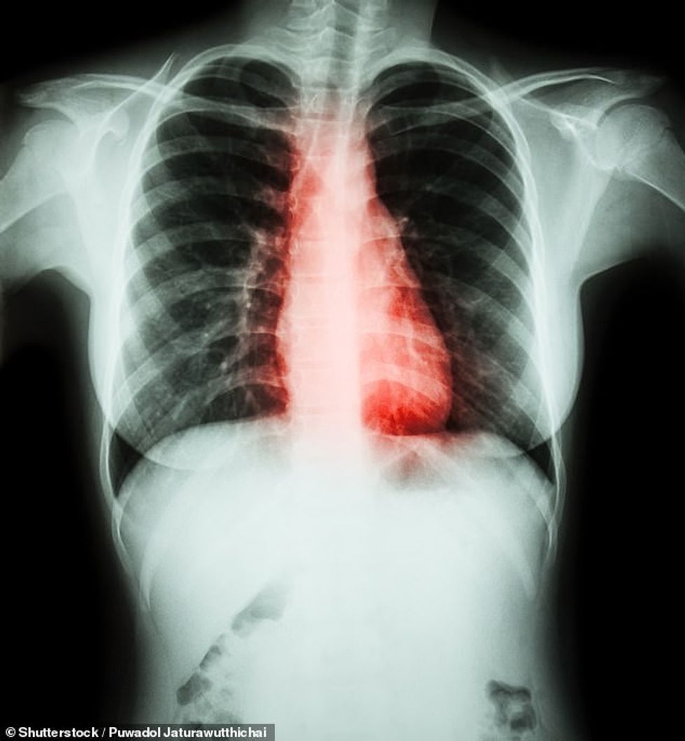 60422429 11026039 image a 36 1658189579154