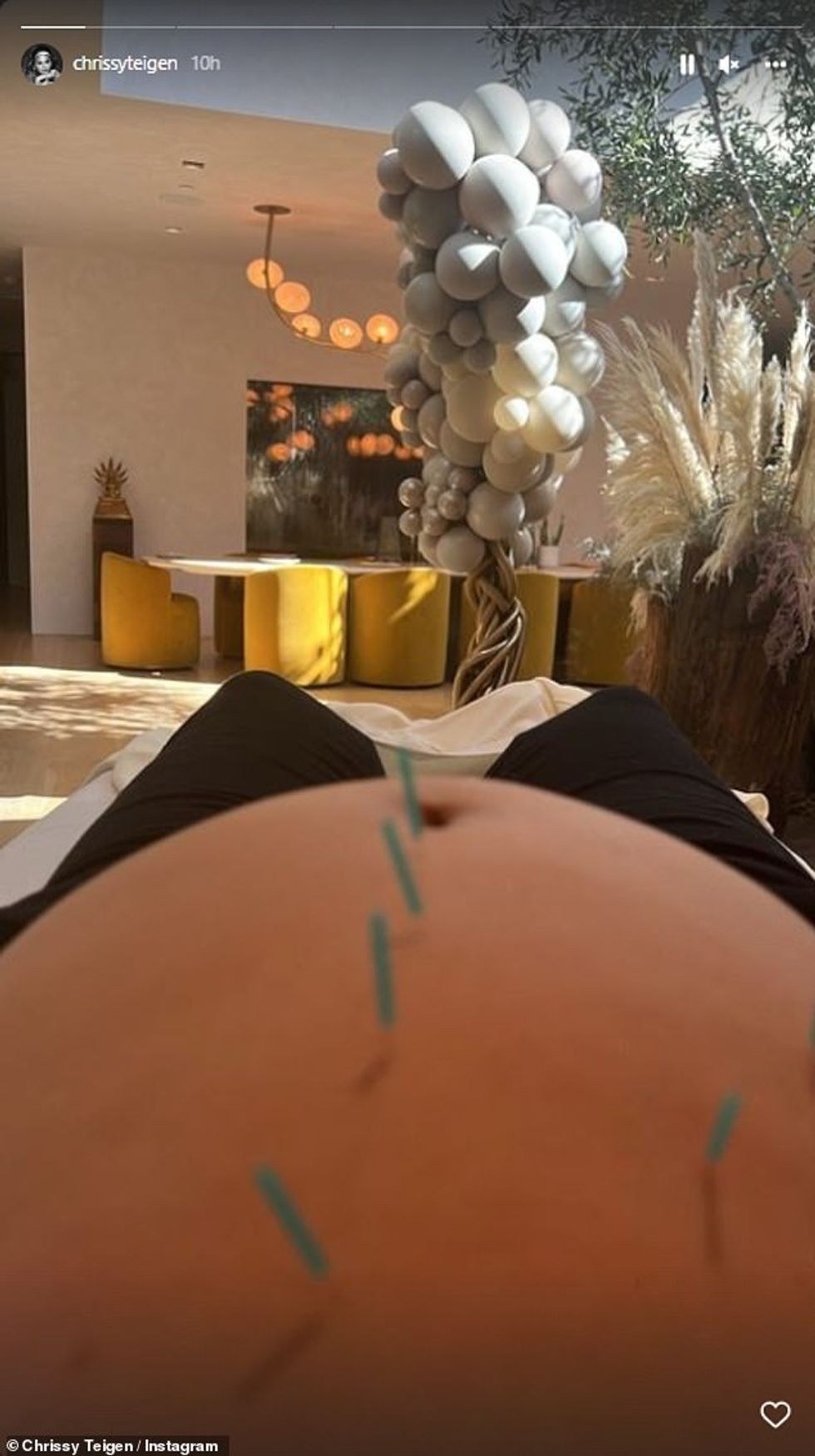 61249637 0 Pregnant Chrissy Teigen shares picture of her growing bump durin a 15 1660126153234