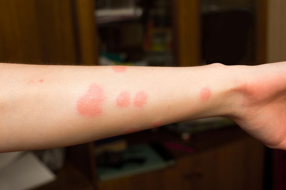 6159235 shutterstock 705005371 ff