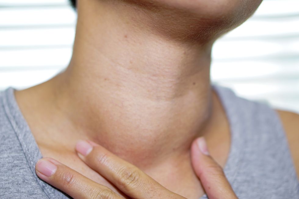 62700 hyperthyroidtx cancerrisk.istock 1146196536