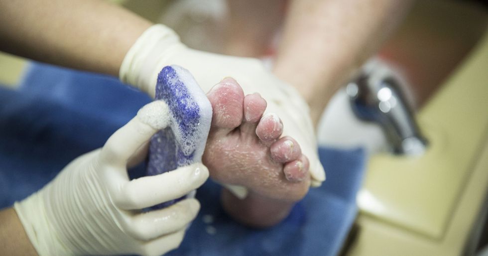 635863318232336856 MNI 1222 Pedicure03