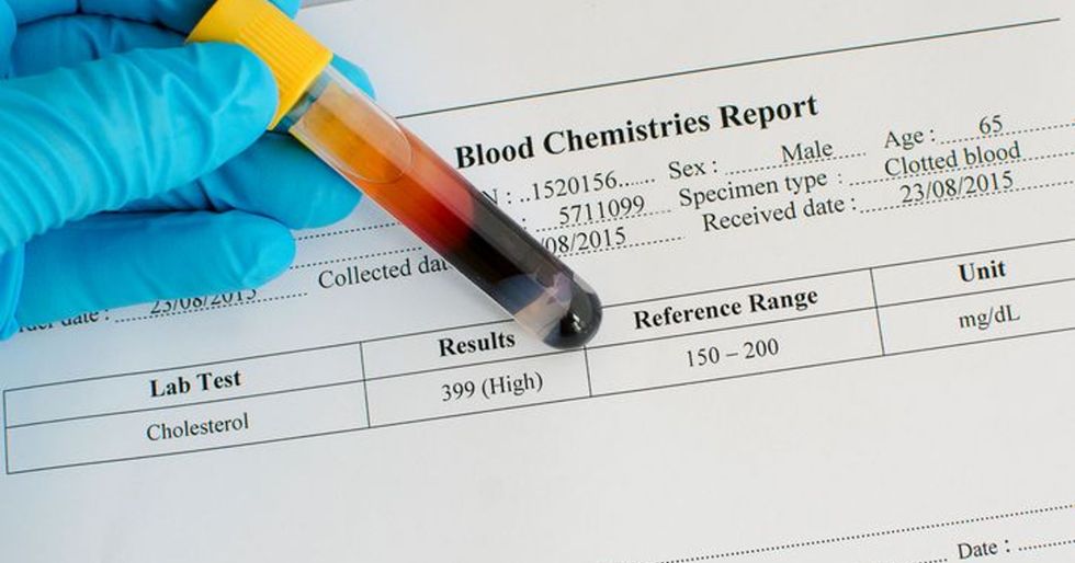 636056435518727998 ThinkstockPhotos 486736360