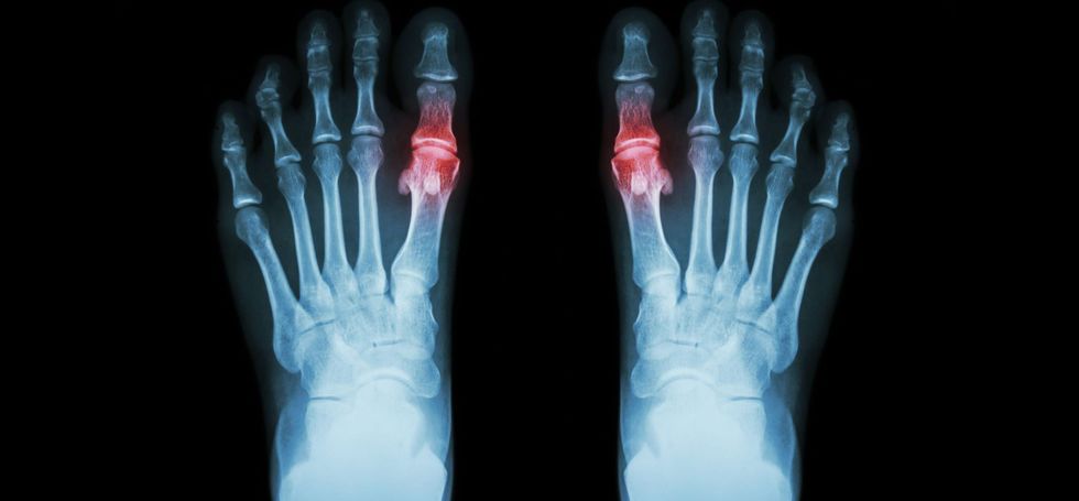 636492161451830645 GettyImages 487244380