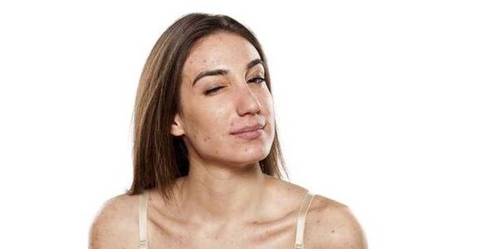 65624114 skeptical young women with problematic skin