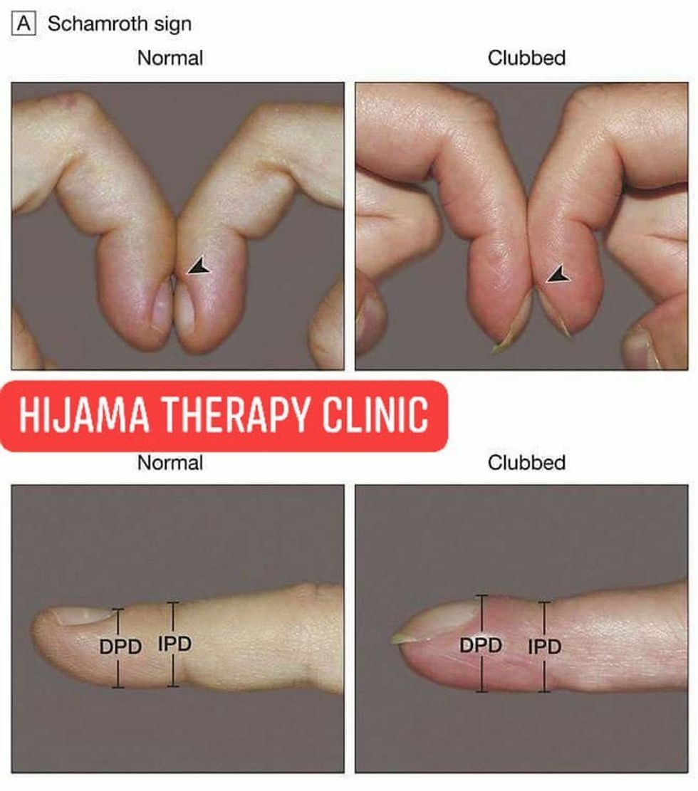 7169916622219489679173384228564627702677504n