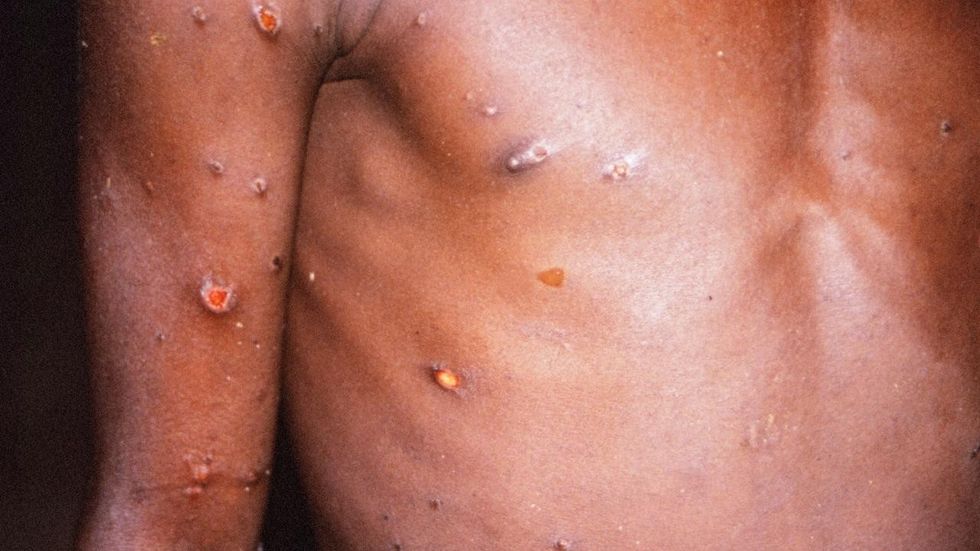 865de7182961bd25ebc5c2d24dc421ba