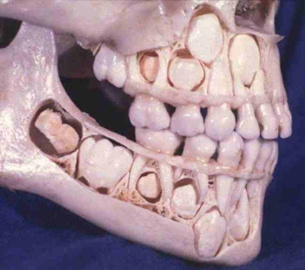 9 10