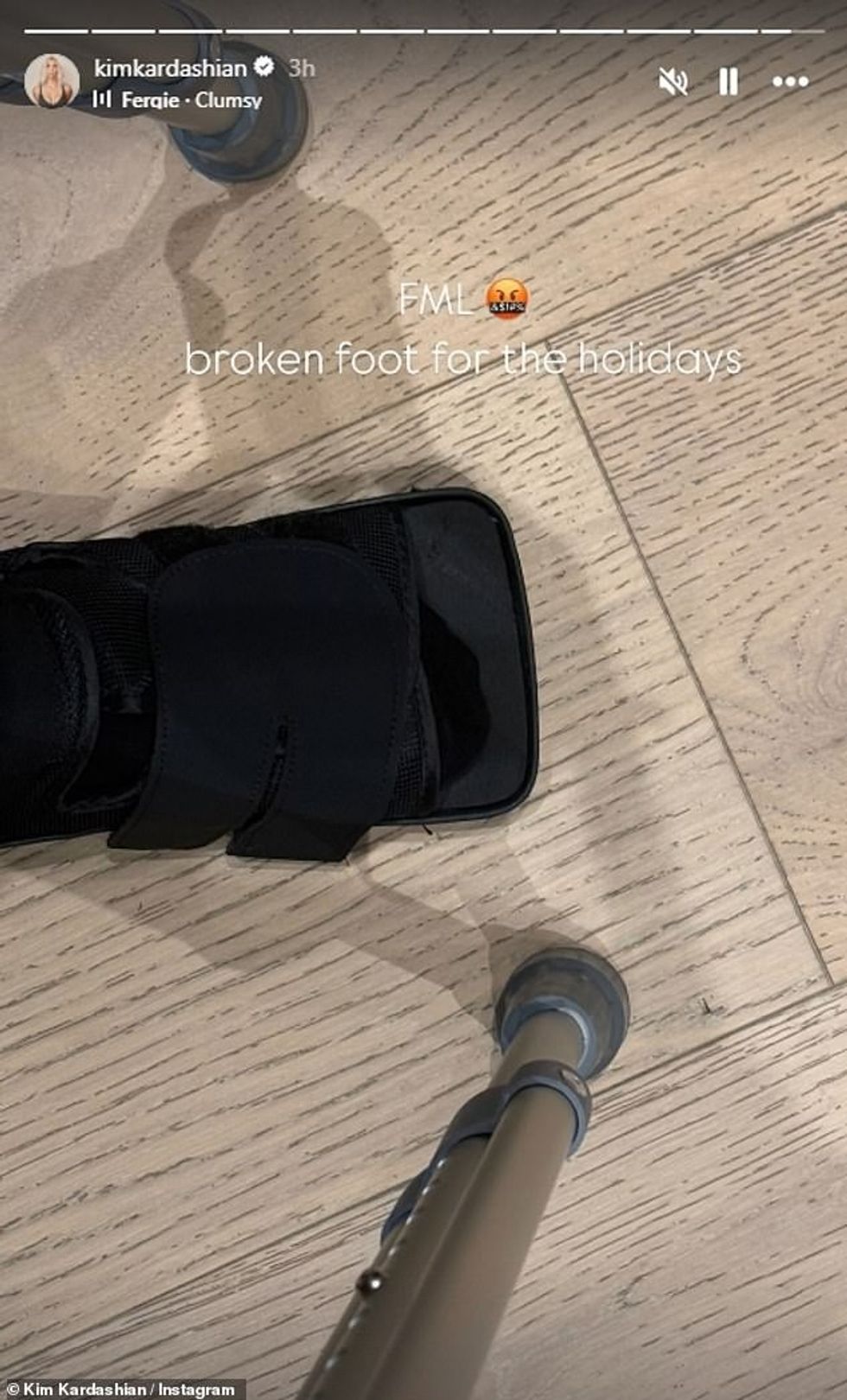 92892067 14167193 Kim Kardashian has suffered a major mishap she broke her foot Th a 62 1733525790440