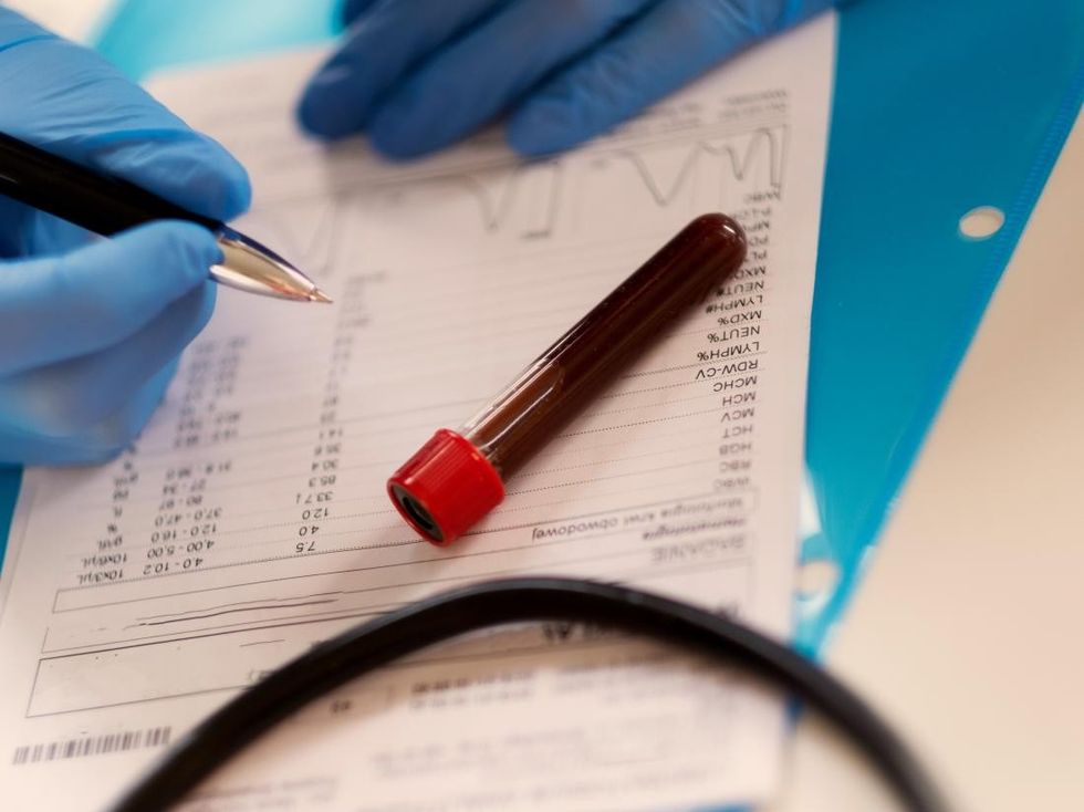 a blood tests lying on top of a document