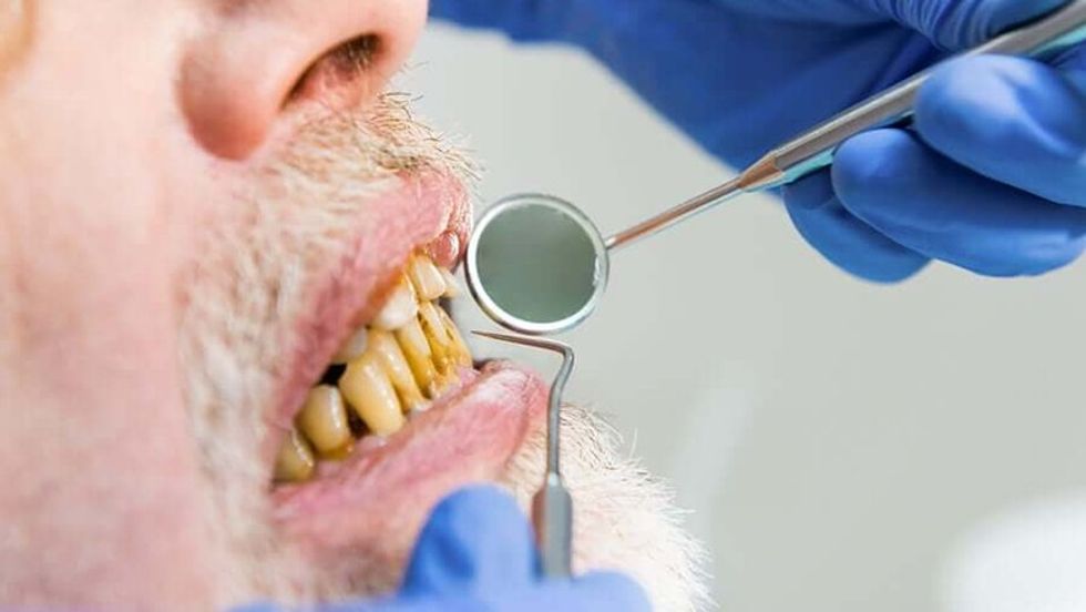 A man with yellow teeth. 1