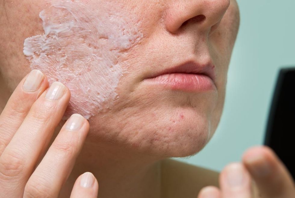 a woman treating acne and wondering the differences b