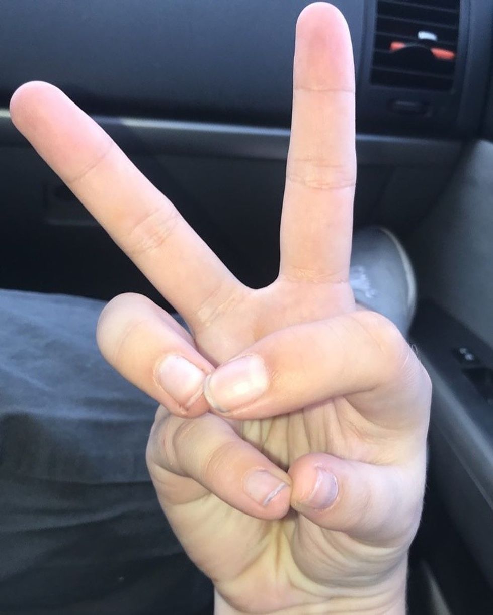 A1