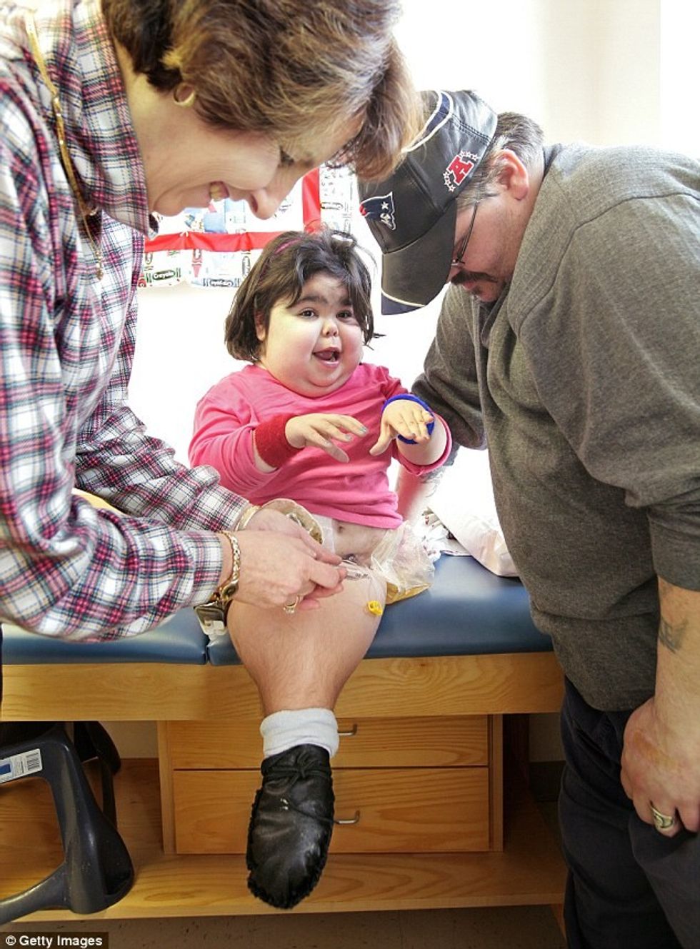 Abortohet bebja sirene qe ne vend te kembeve kishte nje bisht foto 3