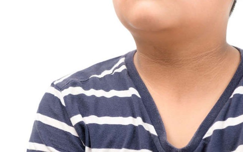 Acantosis nigricans la enfermedad del cuello negro