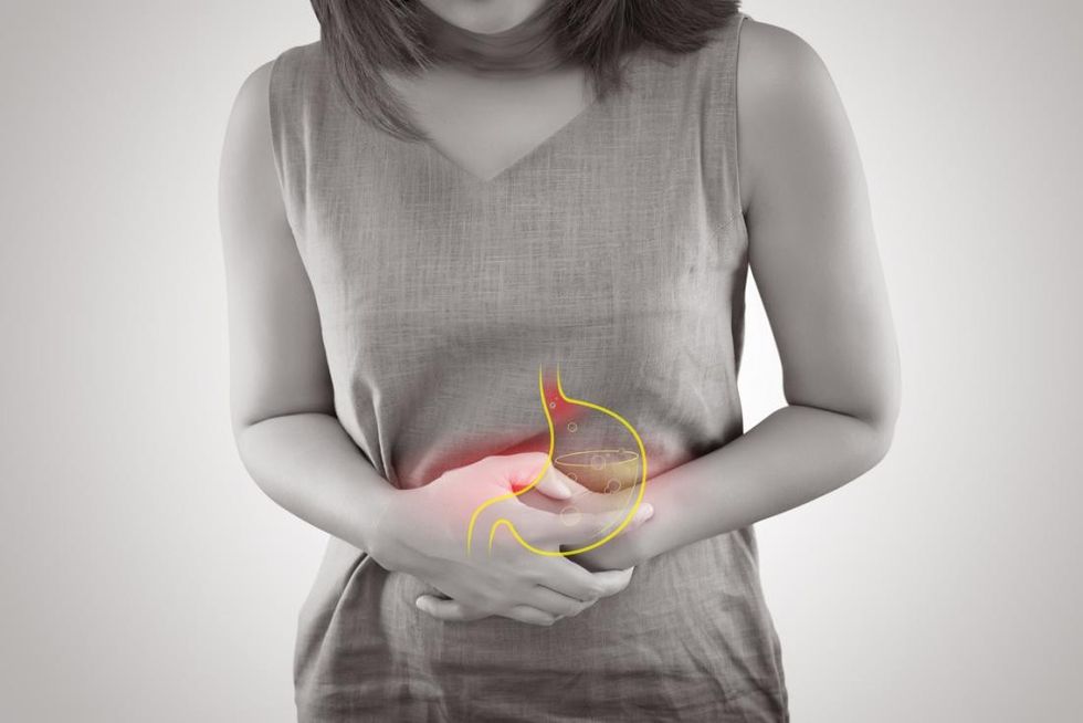 acid reflux stomach