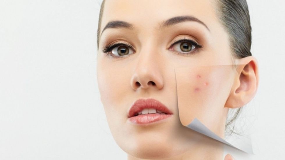 acidi glikolik ndihmon luspimin