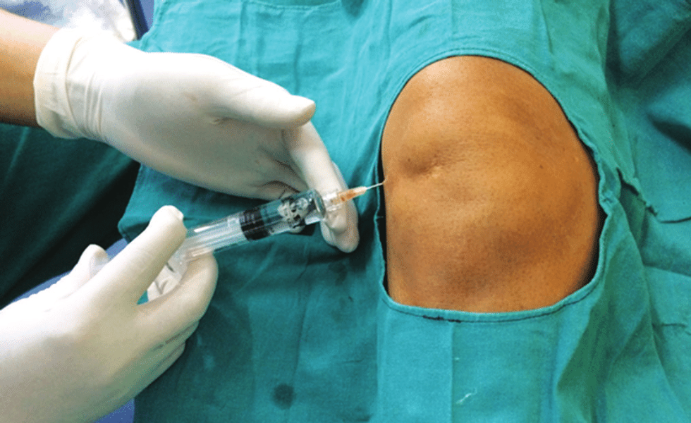 Administering IA HMWHA to knee