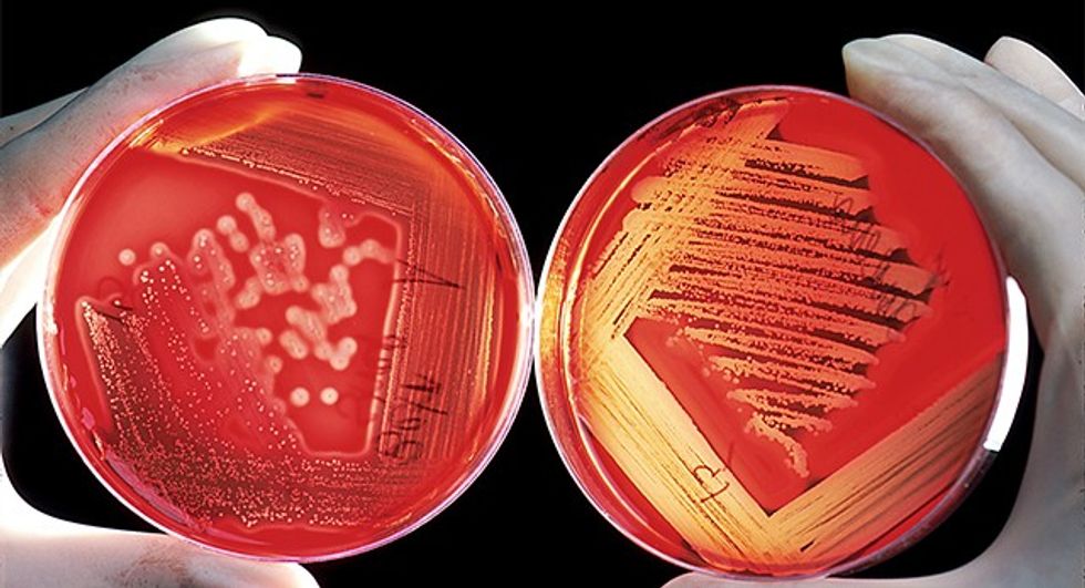 Agarplate_redbloodcells_edit