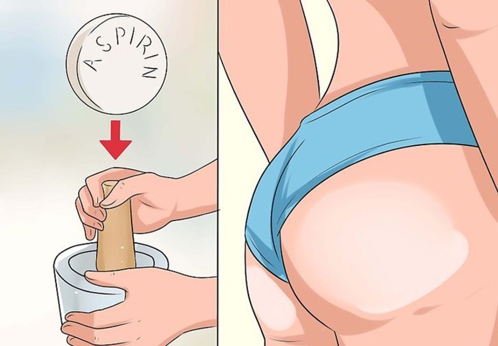 aid862640 v4 728px Get Rid of Acne on the Buttocks Step 6 Version 2