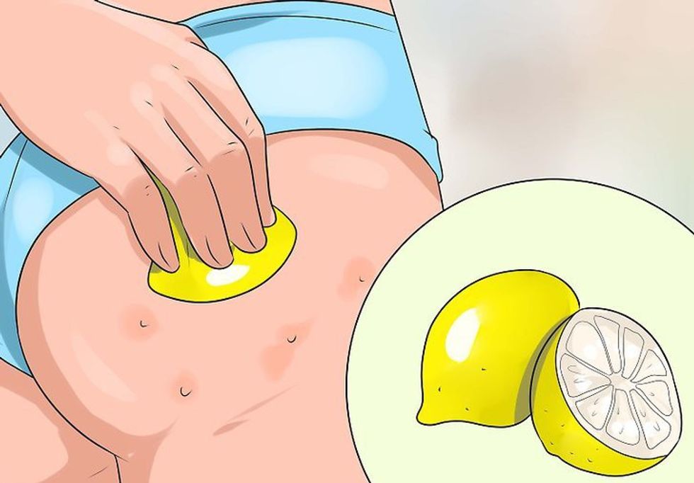 aid862640 v4 728px Get Rid of Acne on the Buttocks Step 7 Version 2