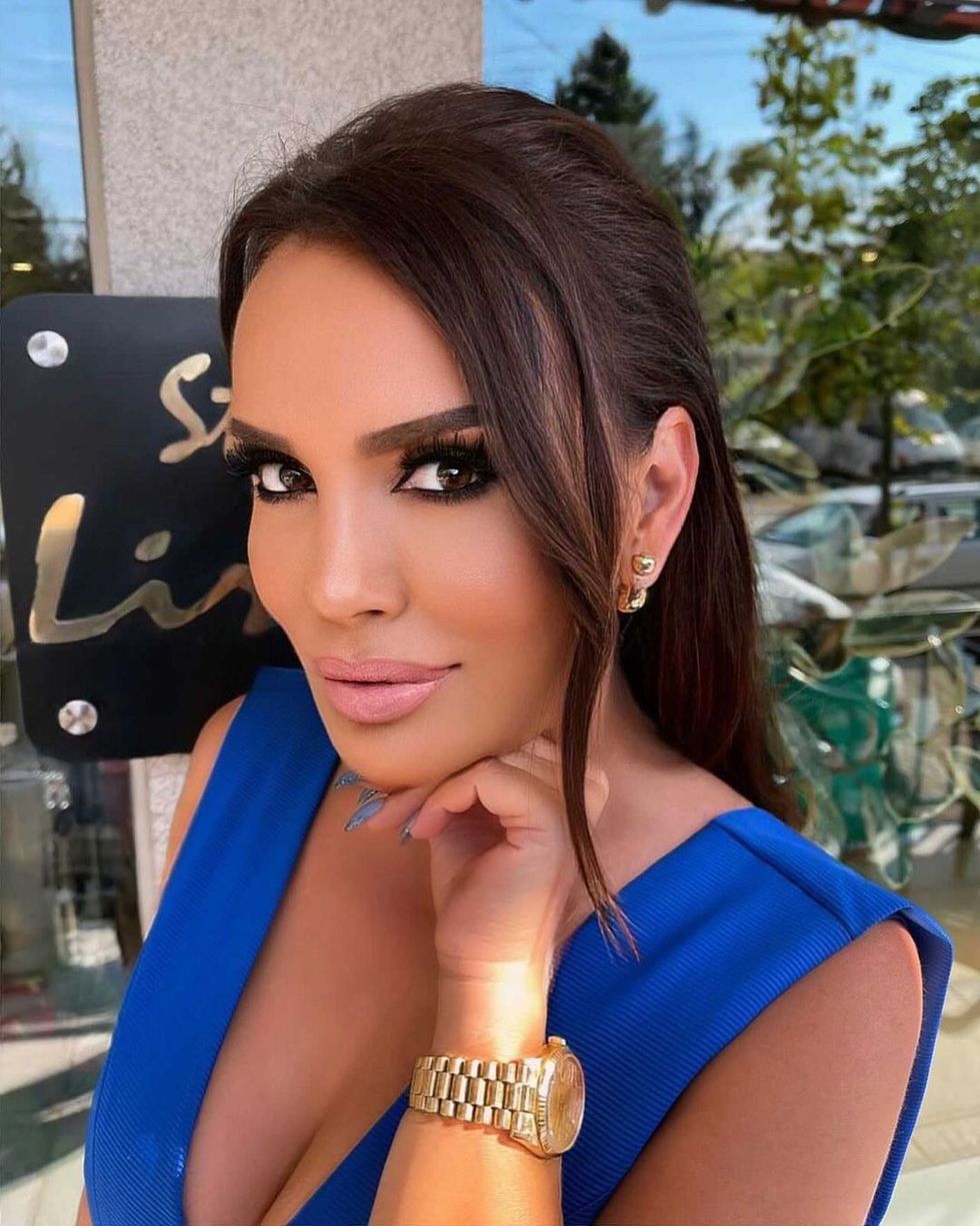 alberije hadergjonaj 223912643 412695163417269 7353364602592565797 n