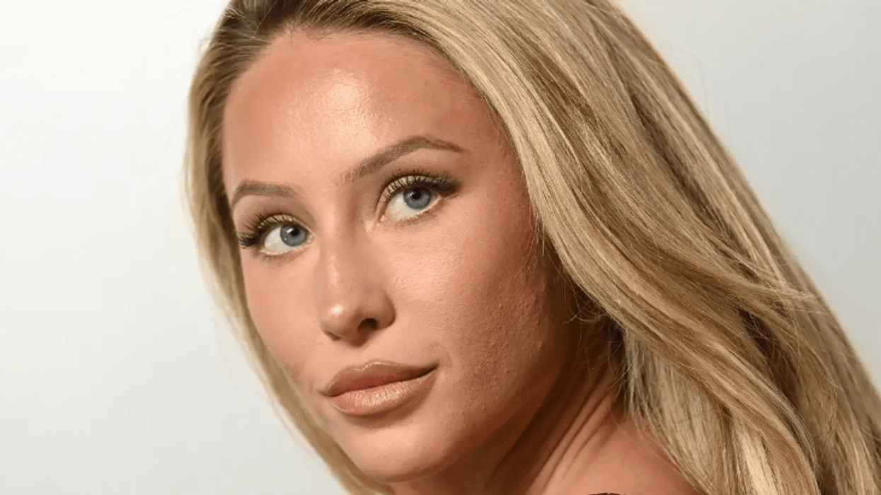 Influencerja Alix Earle rrëfen vështirësitë me shëndetin mendor: Pësova sulm paniku për shkak të komenteve negative