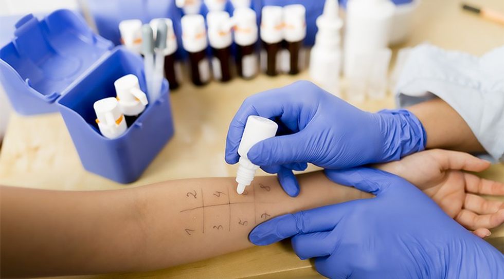 Allergy - skin prick tests