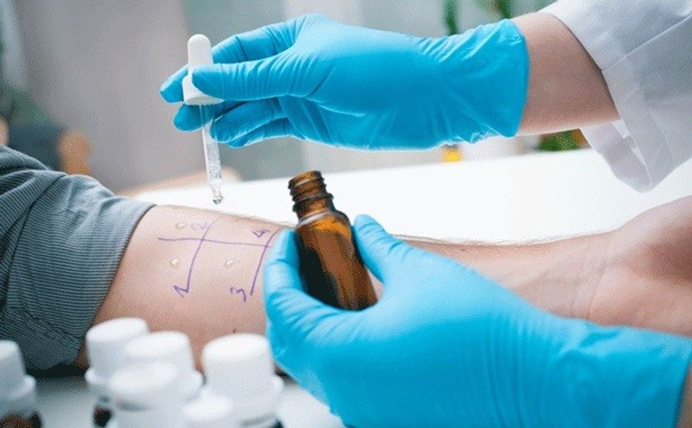 Allergy skin test(2)