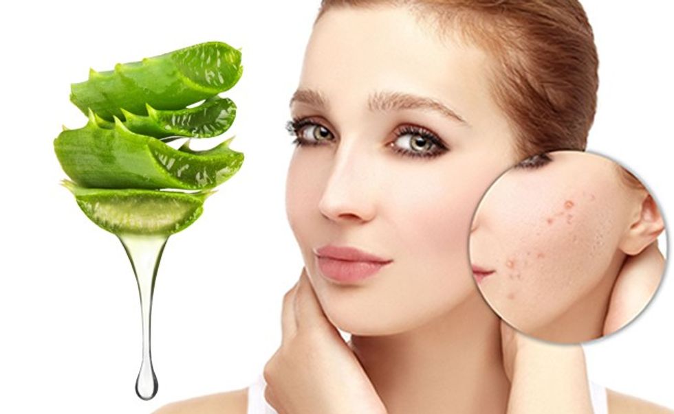 aloe vera cream for acne free fairer skin
