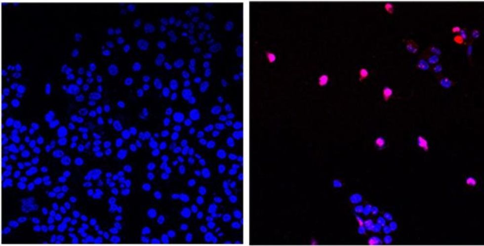 AOH1996 programmed cell death
