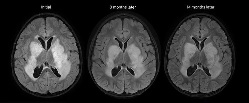 apt follow up results