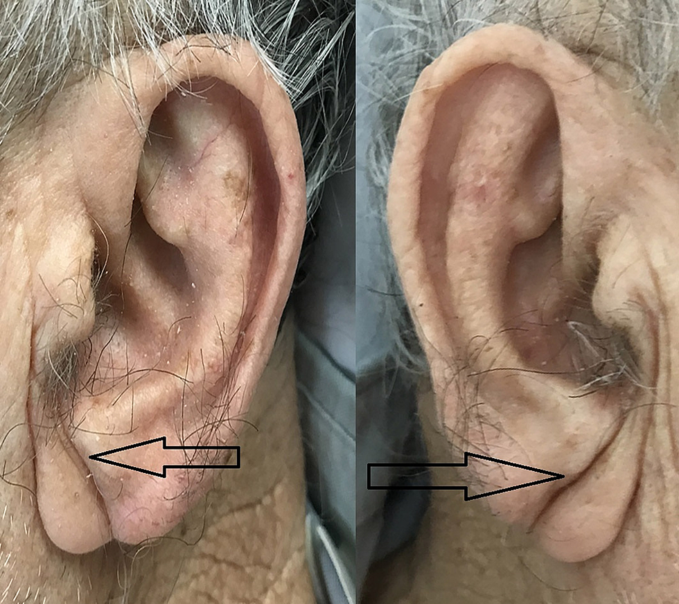 article river dcaa45b0f28811e785c263e62b1aa60d Figure 1.jpg edited