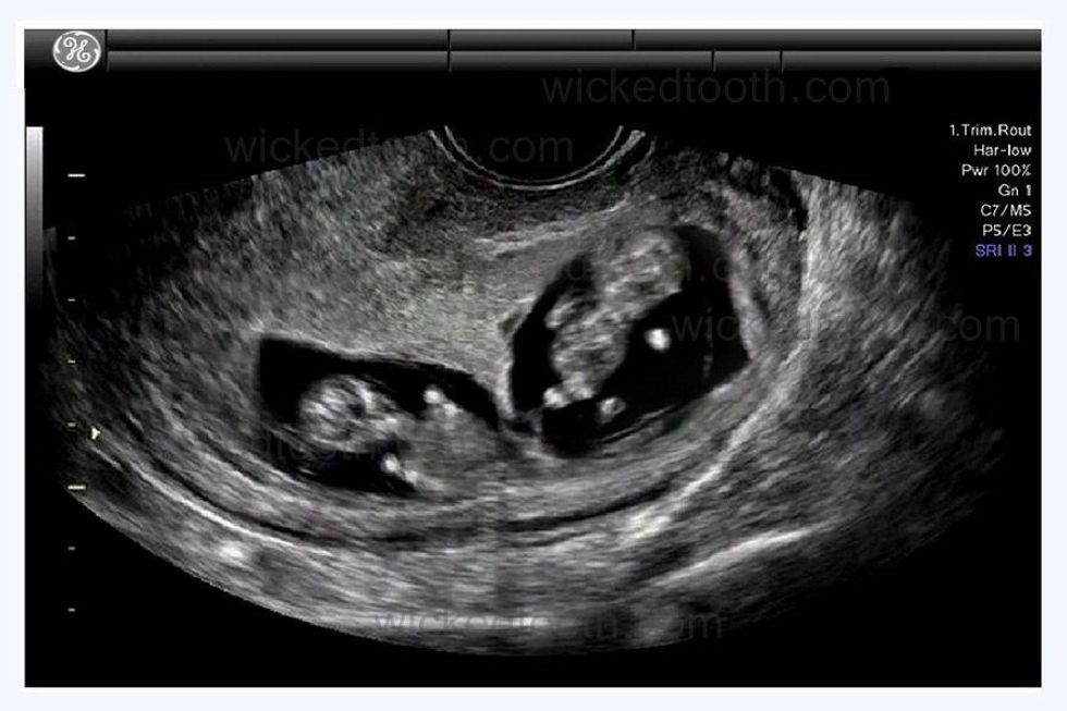 b5c1a7ab6ede61f01edd3f5586fbba70