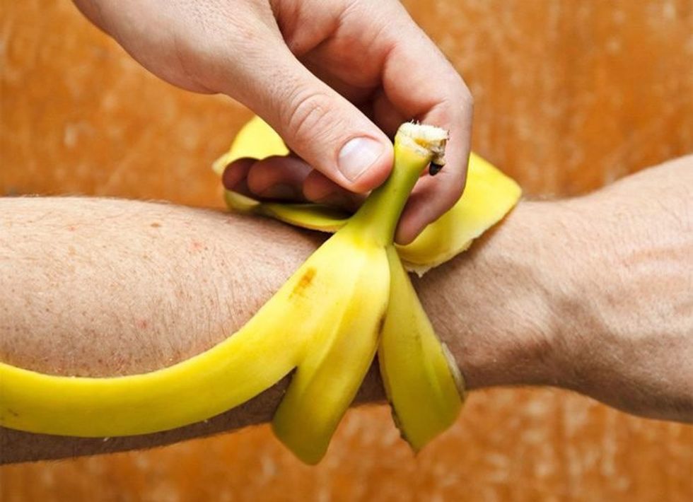 banan peel misquito bite hack 1 edited