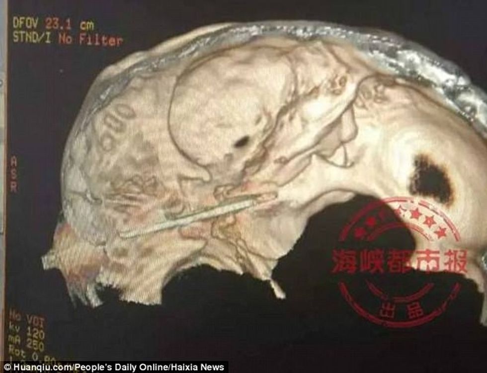 Bashkëshortja e qëllon me thikë në sy pret rend ne spital si çdo pacient tjeter foto 3